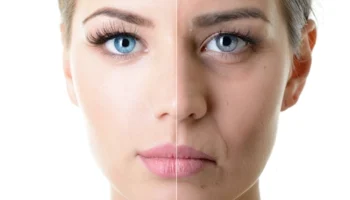 Orta Yüz Yaşlanması Nedir