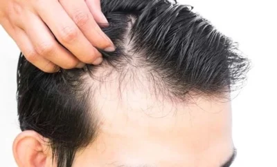 Saç Dökülmesini Önlemek