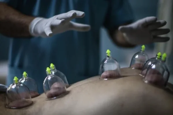 Oruçluyken Hacamat Yaptırılır mı