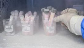 Türkiye’de Bir İlk: Deri Bankasına Bağışlar Artıyor