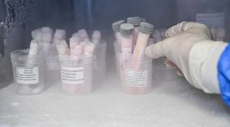 Türkiye’de Bir İlk: Deri Bankasına Bağışlar Artıyor