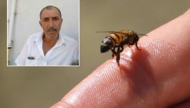 Arı sokması