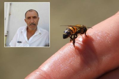 Arı sokması